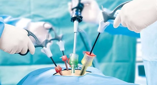 Infertility Treatment